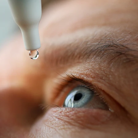 Patient putting glaucoma eye drops into their eye